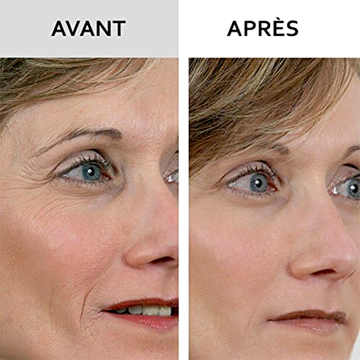 Wrinkle Power : Avis honnêtes sur ce produit anti-rides !